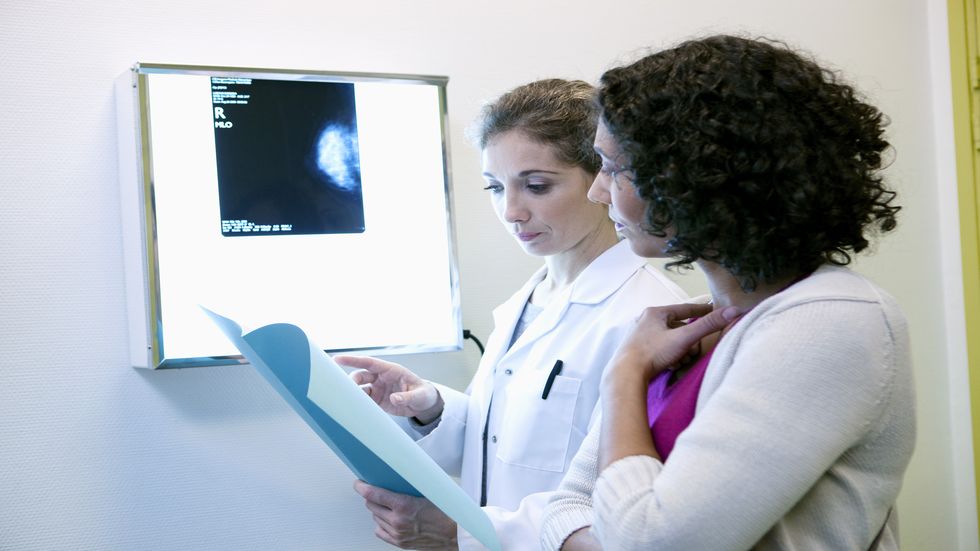 cancer la san mamografie
