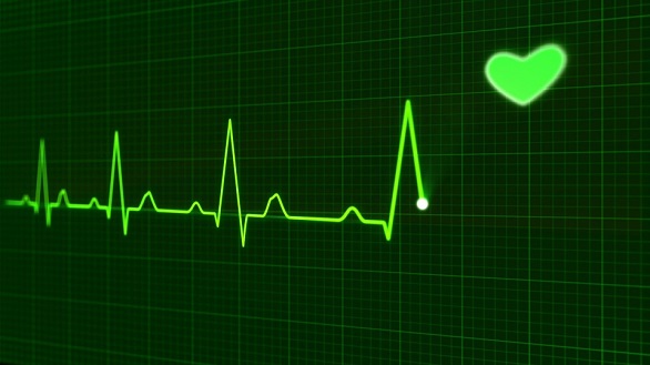 EKG
