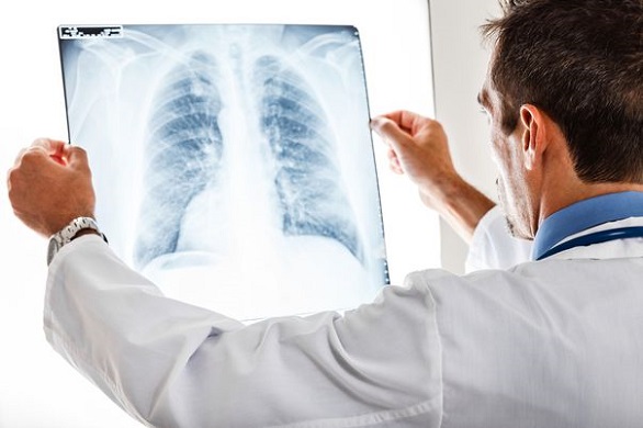 medic care citeste o radiografie