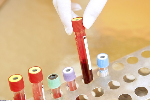 Analize medicale