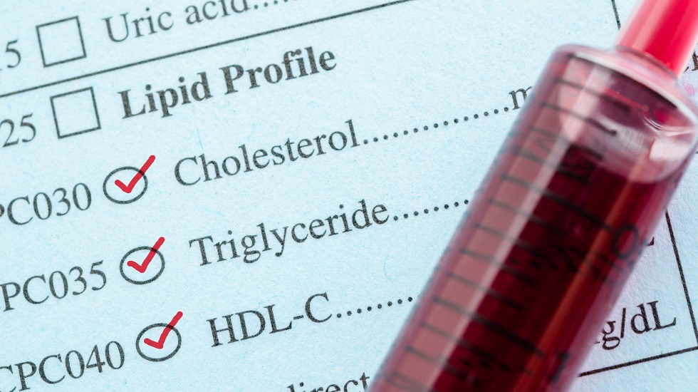 Ghidul analizelor medicale