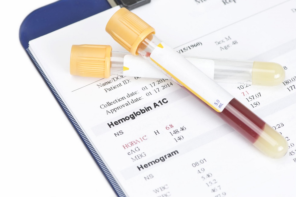 Hemoleucograma