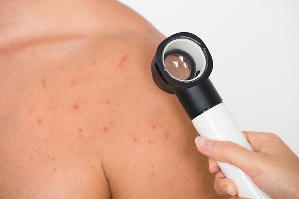 control dermatologic