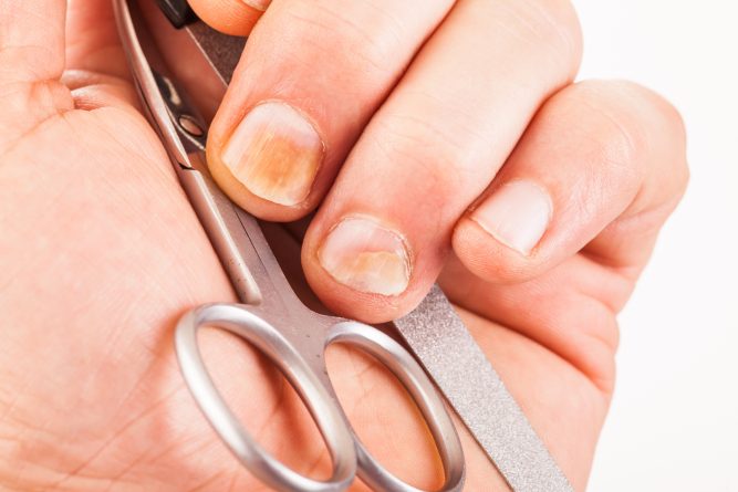 Wrap Colleague Rally Cum să faci cel mai bun întăritor pentru unghii fragile și exfoliate | Frumusete | Avantaje.ro - De 20 de ani pretuieste femei ca tine Wrap Colleague Rally Cum să faci cel mai bun întăritor pentru unghii fragile și exfoliate | Frumusete | Avantaje.ro - De 20 de ani pretuieste femei ca tine