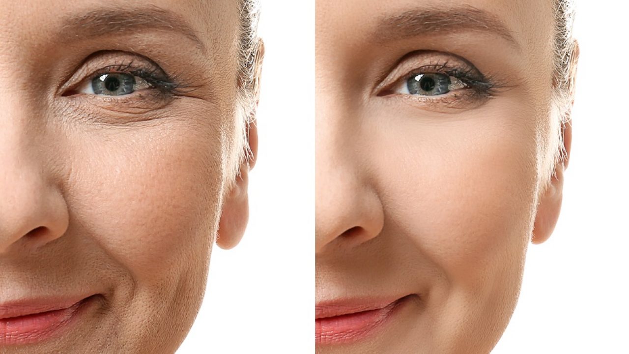 cauzele precoce ale ridurilor faciale Cremă anti-îmbătrânire cu siloxan și peptide