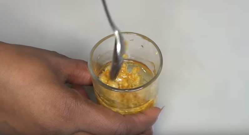 cazuri de vindecare varicoasa geluri varicoase care mai bune
