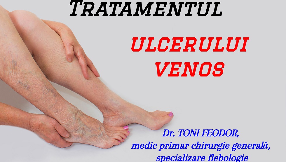 traiesc sanatoi despre tratamentul varicozei cumpara osete de la varicoza