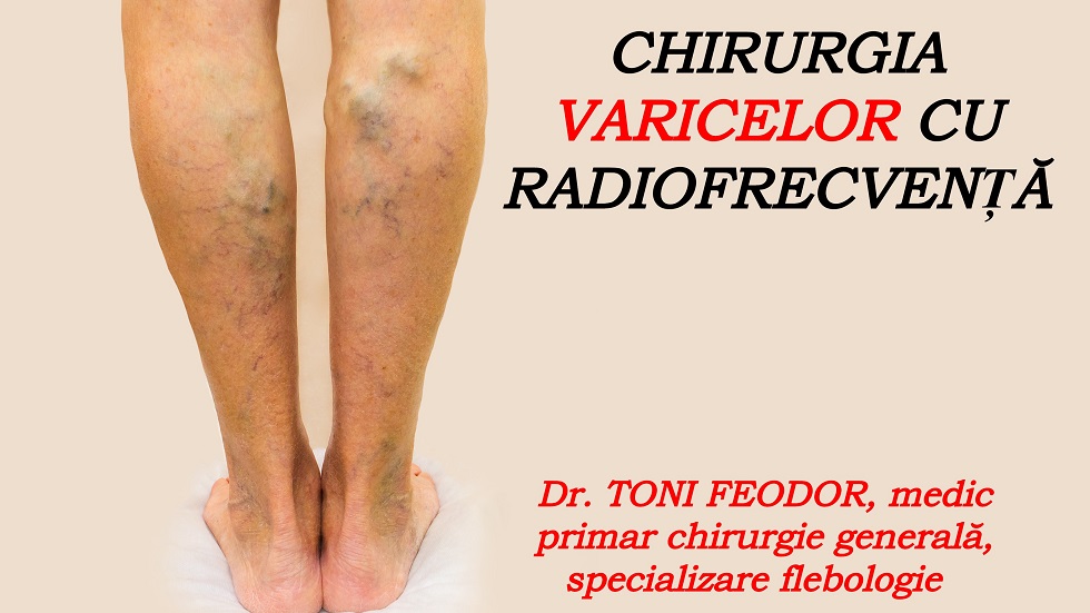 doctor cu picioare varicoase