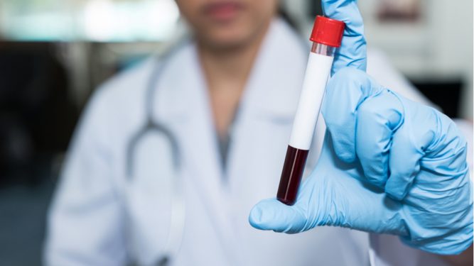 Infecţia cu virus hepatitic C (VHC)