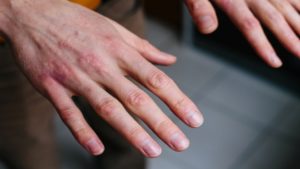 va ajuta patinajul cu role să mi pierd greutatea scoateți stocul de grăsimi